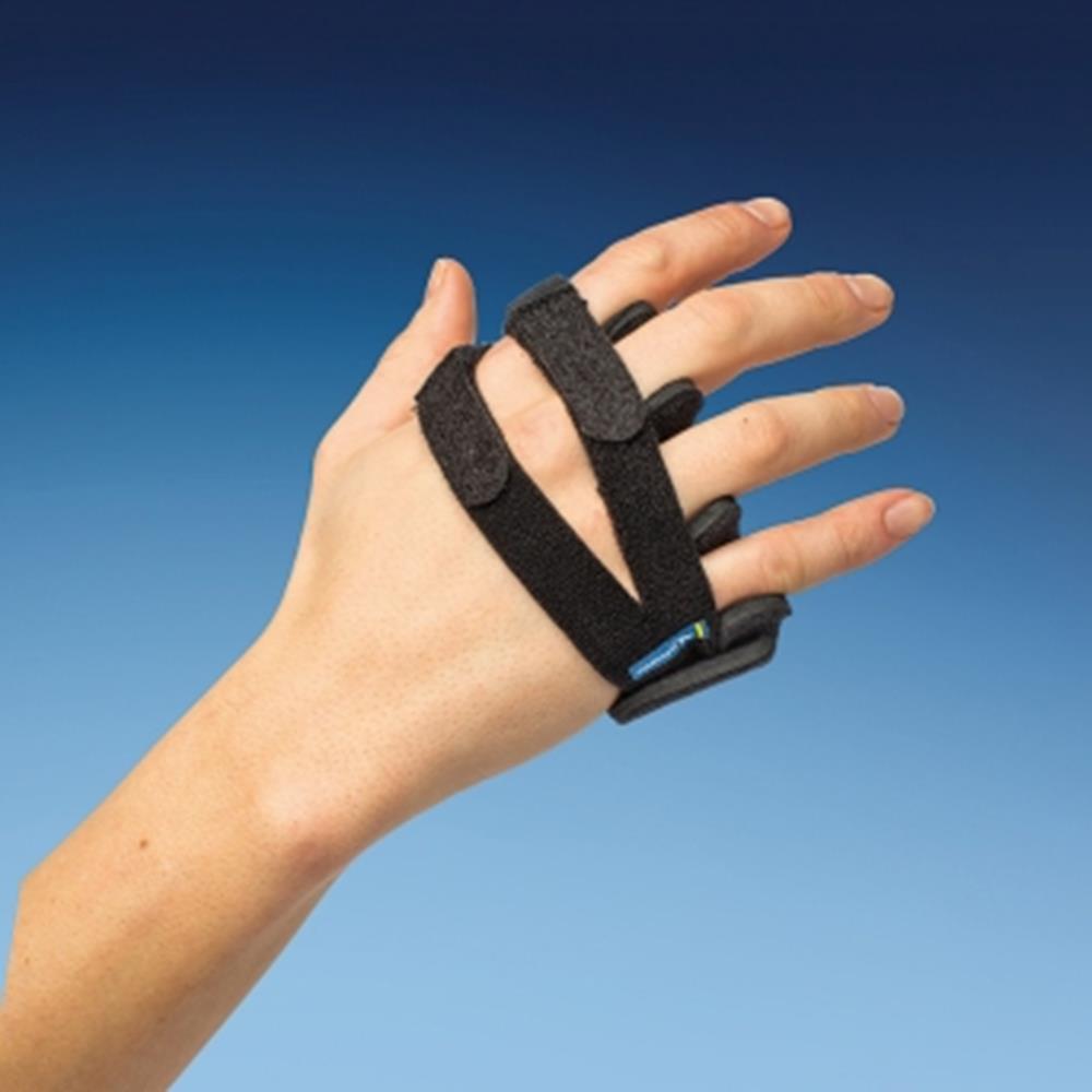 Ulnar Deviation Splint / rheumatoid arthritis and other inflammatory processes.