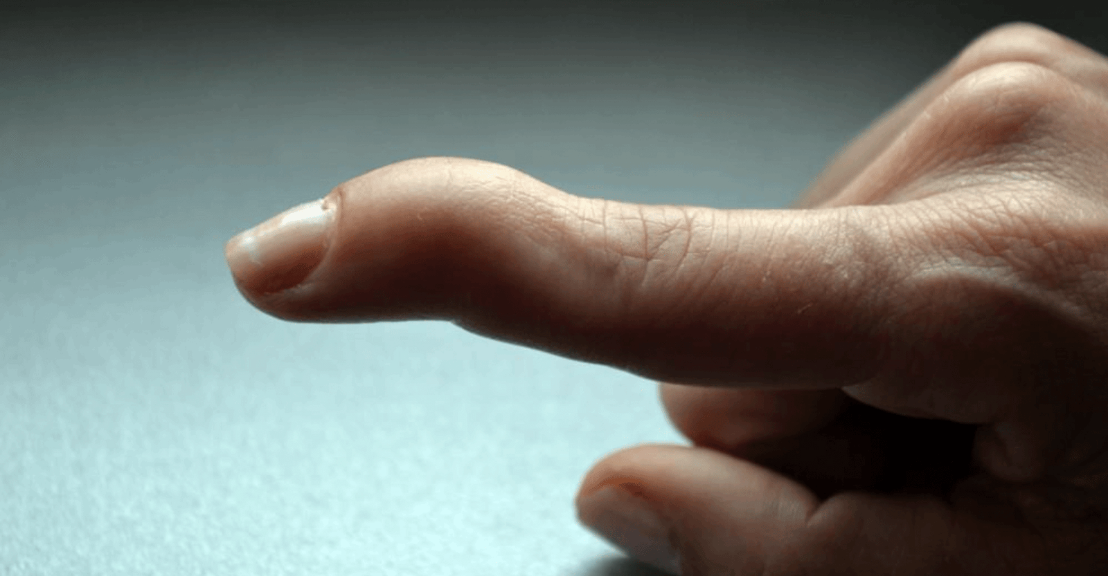 ring finger crooked | חיפוש ב-TikTok