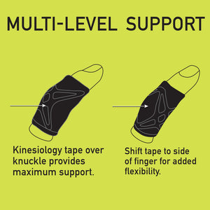 SparkFingerSplintDiagram