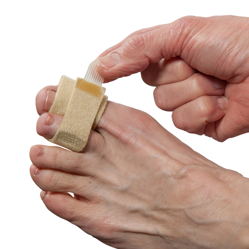 Toe Connection Toe | Toe braces & splints, loops | Crooked toes | Toe fractures ...